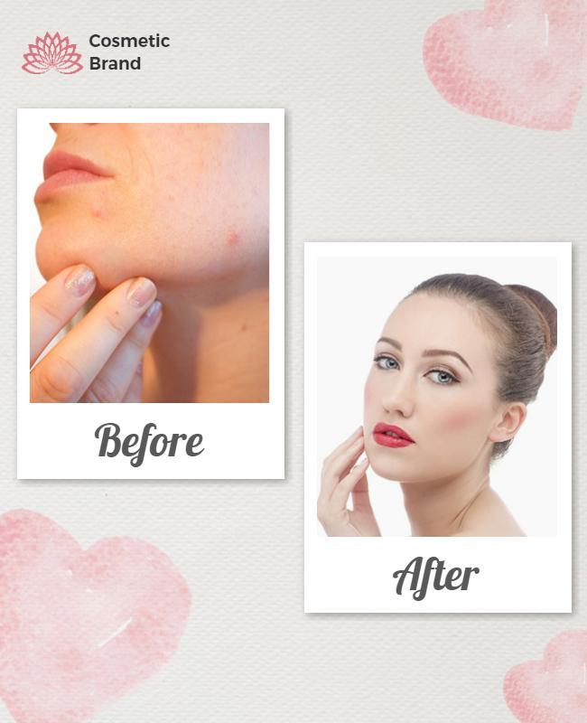 Cosmetic Brand Skincare Transformation Flyer Template