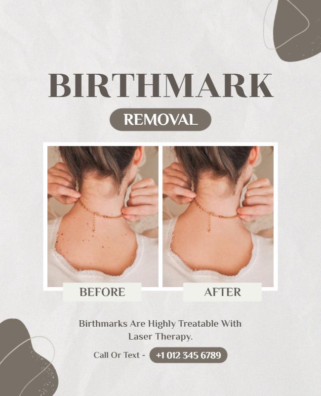 Laser Treatment Birthmark Removal Flyer Template